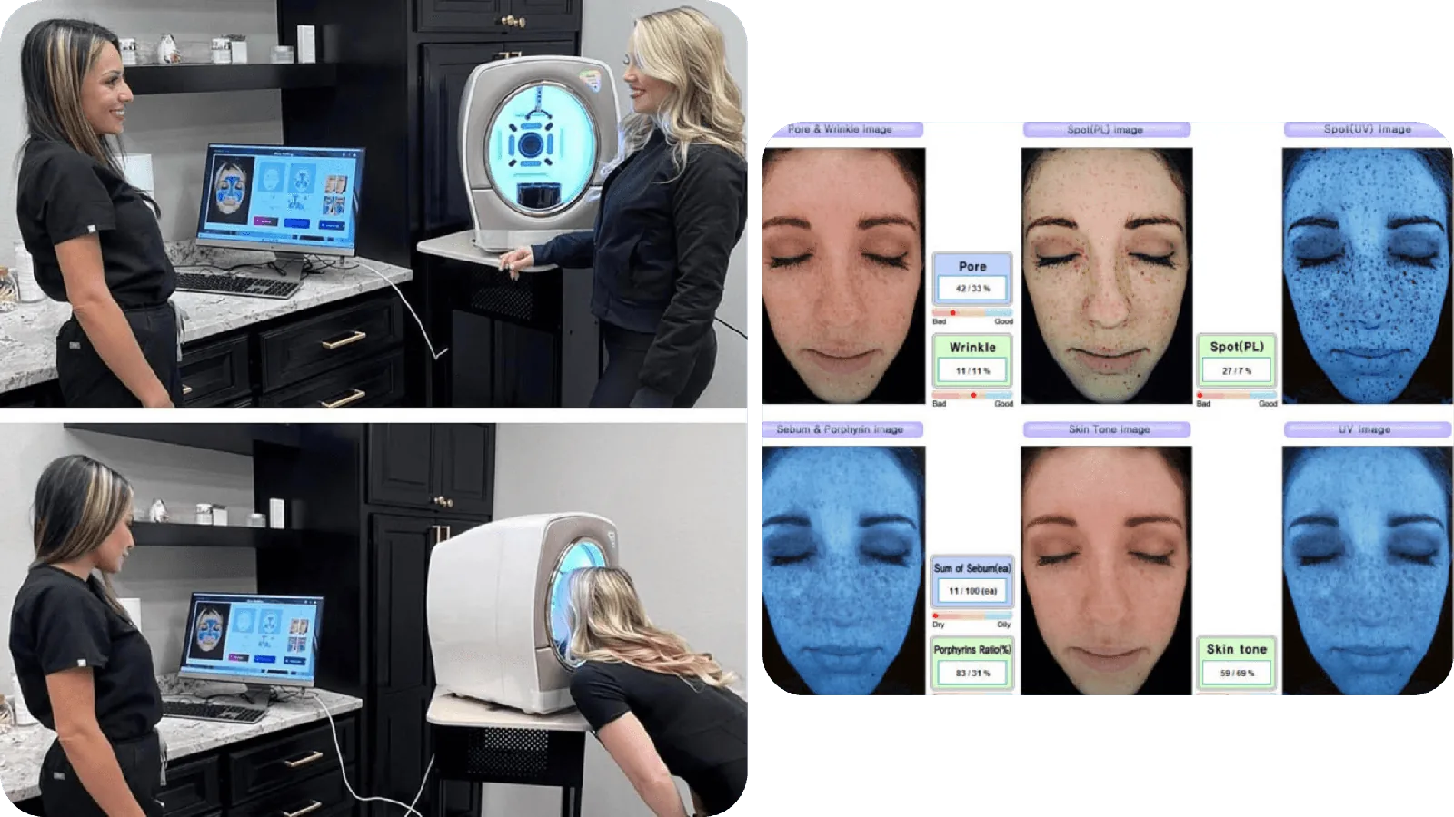 Emage-R Skin Analysis System in use